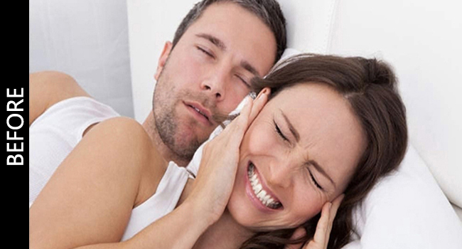 cpap chin strap to keep mouth closed