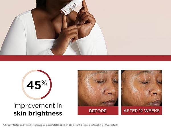 Clinically-Proven Results for UV Clear