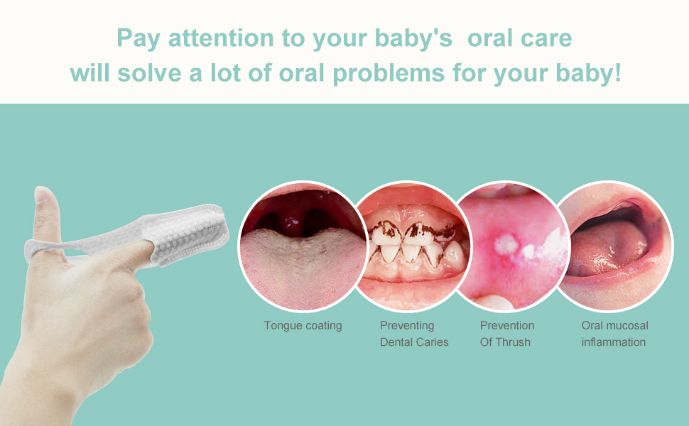 35PCS Finger Cots Baby Mouth Cleaner, Baby Tongue Cleaner