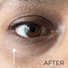 4 Weeks After using Peptide Eye Gel