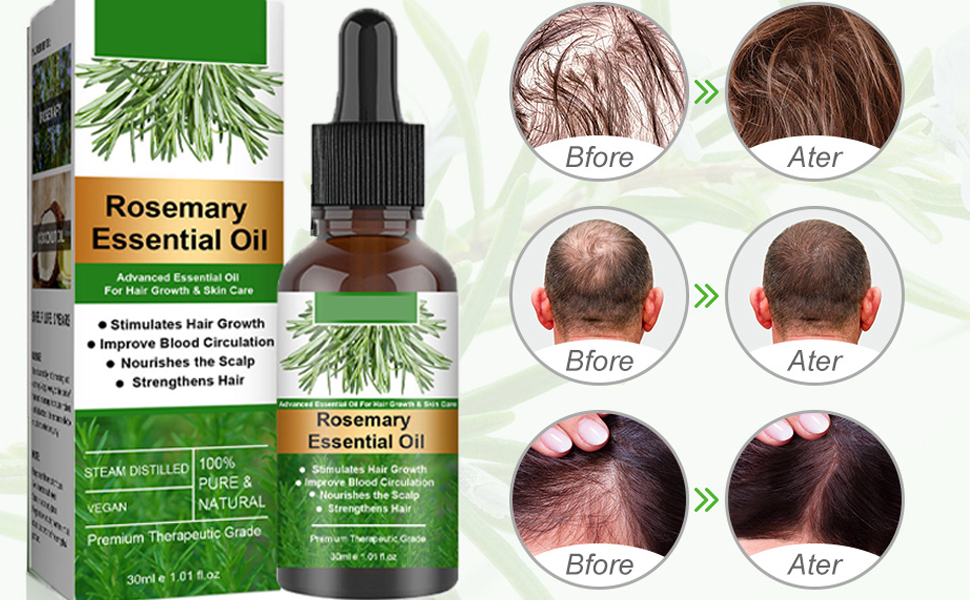 rosmarin oil hair growth