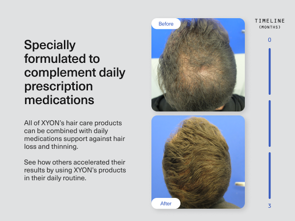 ボディローション advangen scalplotion haircycle care 28mL The New Standard in Treating Hair Loss | XYON