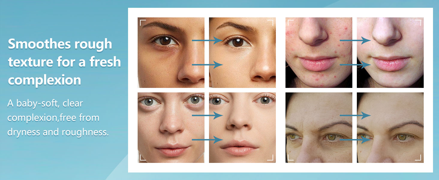 fresh complexion