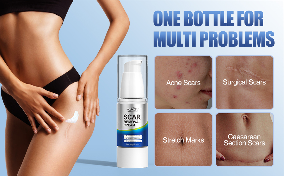 scar removal cream