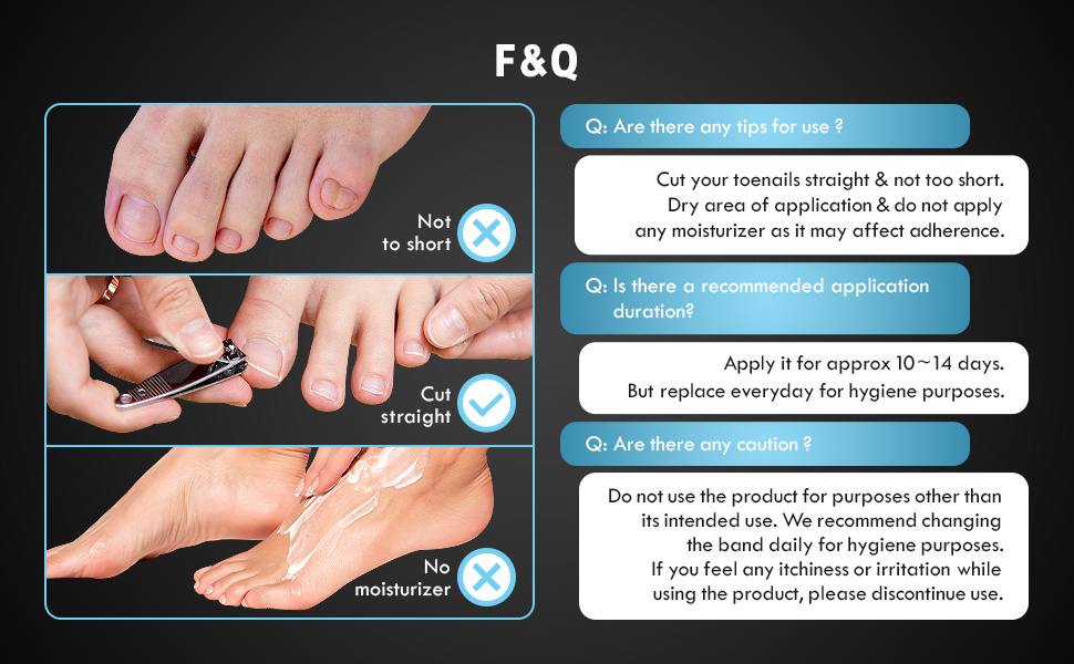 Pincher Pro Band Resistant Ingrown Toenail