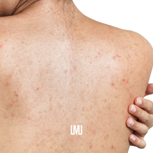 Vista ravvicinata della struttura della pelle con un piccolo segno o macchia rettangolare bianca