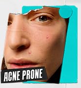 acne prone