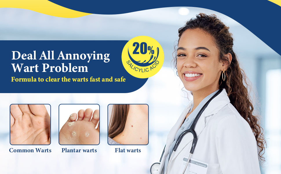 wart renoval