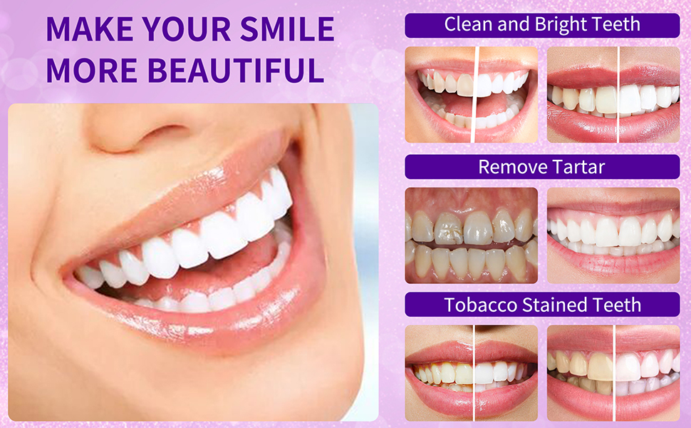 GlorySmile Teeth Whitening Foam Toothpaste, Purple Toothpaste Tooth