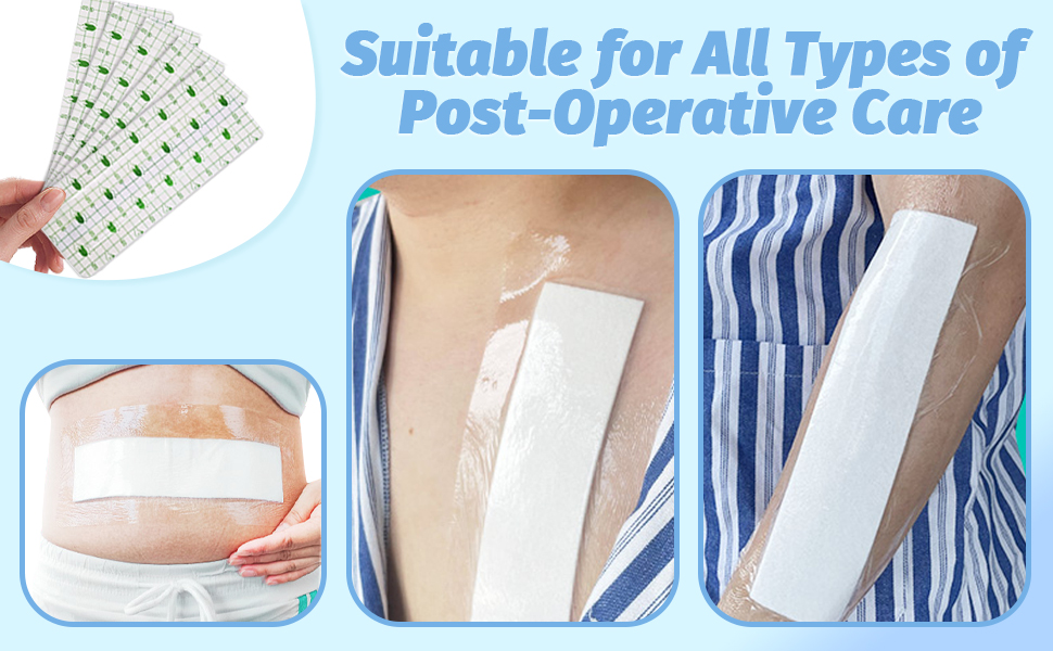 Incision Island Dressing,Section Adhesive Island Wound Dressings Pads