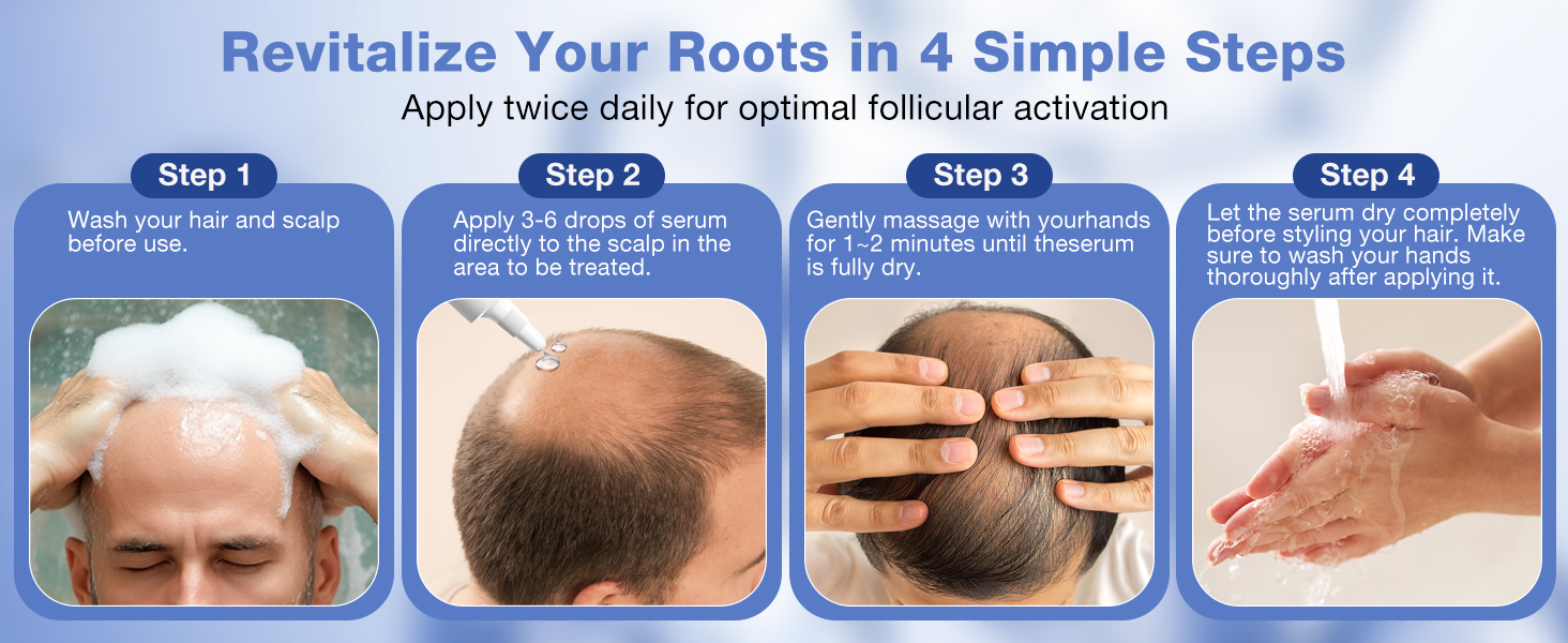 minoxidil for women hair growth