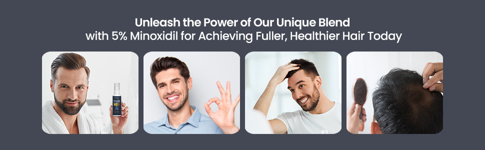 5% minoxidil