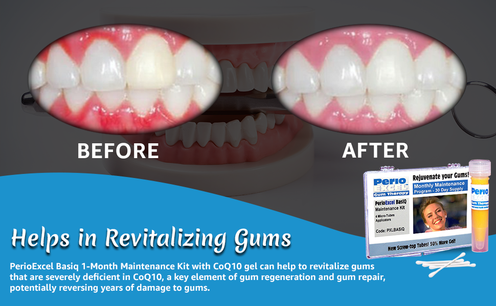 PerioEXCEL Basiq CoQ10 Gum Gel, 4week Maintenance Pack