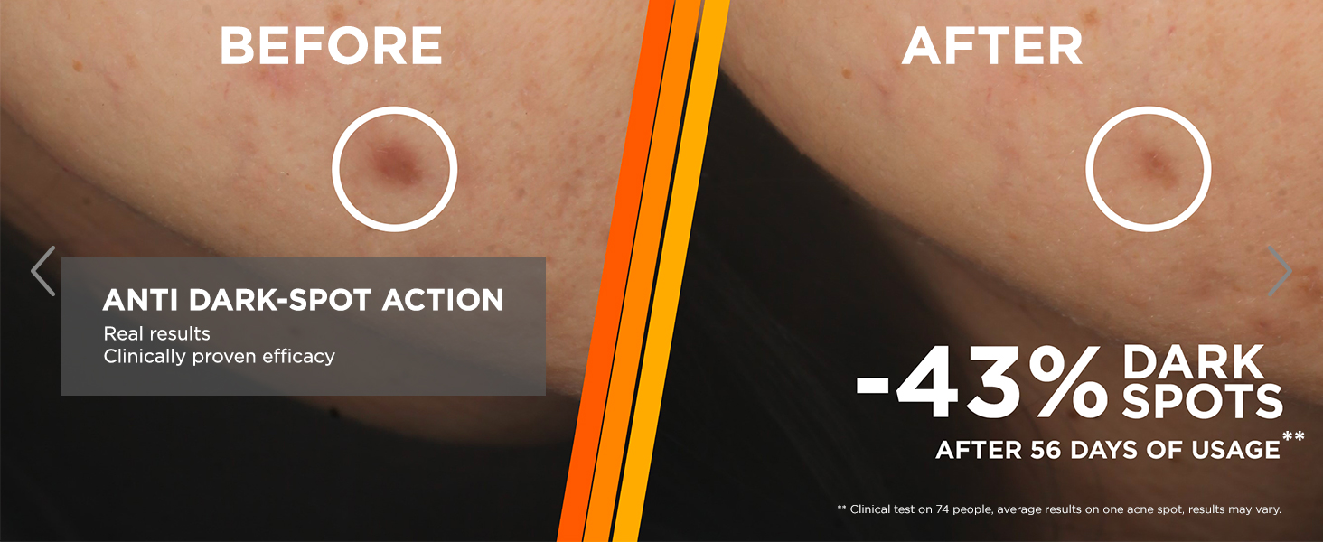 Before and after garnier vitamin c serum