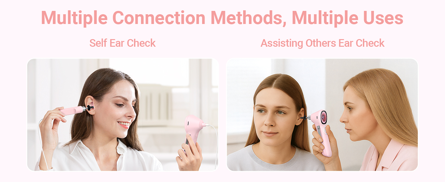 otoscope with light ear scope digital otoscope for kids smart otoscope for iphone