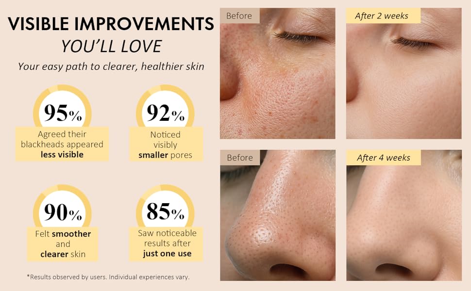 VISIBLE IMPROVEMENTS YOU&#39;LL LOVE