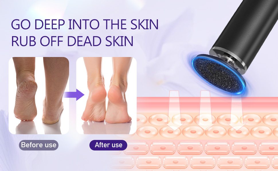 Electric Callus Remover