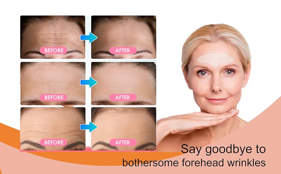 wrinkle patches