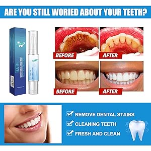 Herbaluxy Teeth Whitening