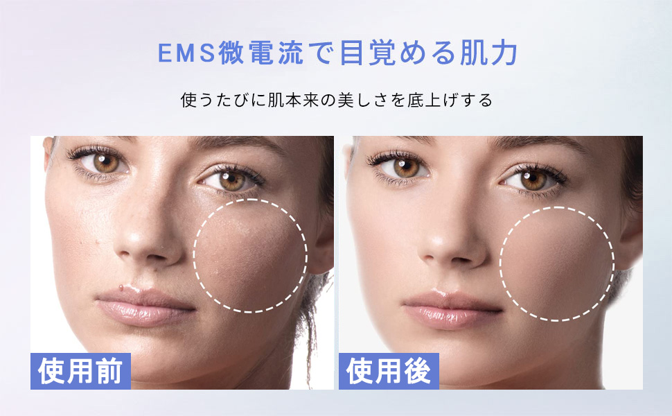 【ほぼ未使用】Kビューティー！高周波リフティング美顔器 careCL CLB 新品未使用）careCL CLB 美顔器 コラーゲンジェル付き ほぼ未