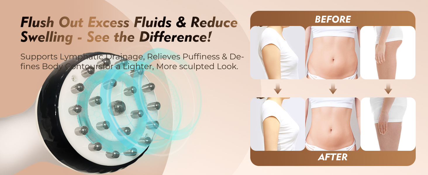 Lymphedema Massager for Swelling