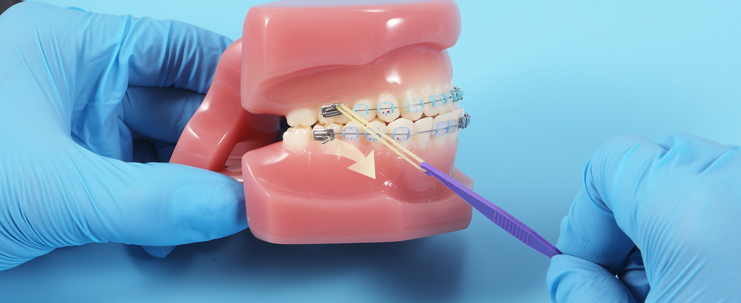 Orthodontic Elastic Rubber Bands 500 Pcs (3.5 Oz, 3/8