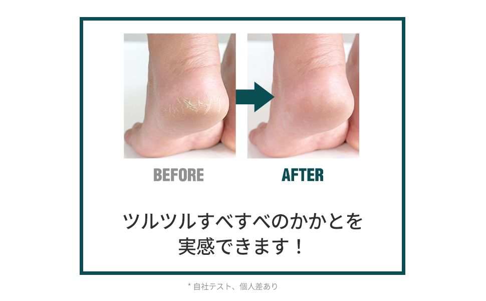 ツルツルかかと★フットクリーム★ドイツ製★ベトつかない ツルツルかかと☆フットクリーム☆ドイツ製☆ベトつかない