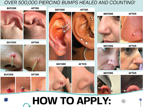 Nose piercing cleaner Hypochlorous acid spray Piercing infection treatment Piercing bump treatment