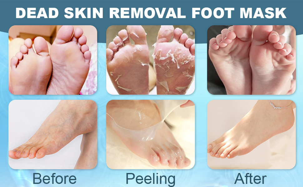 Removes Dead Skin & Calluses SPN-MC368P