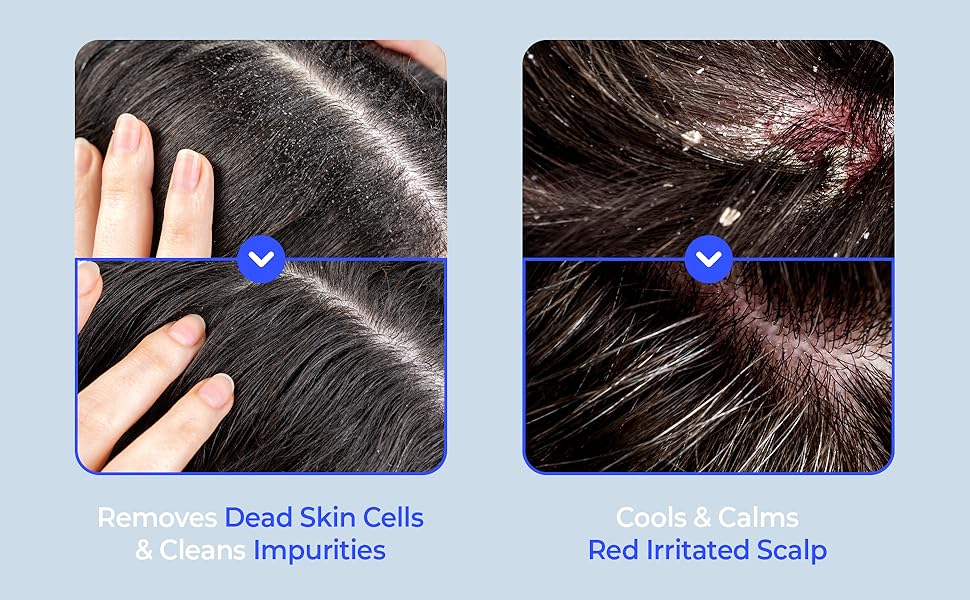 Crazy Skin Antartica Salt Shampoo