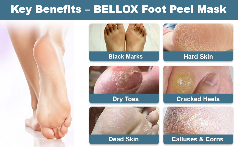 BELLOX Foot Peel Mask for Women & Men SPN-MC368P