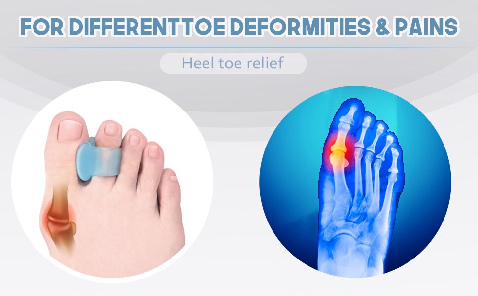 Toe Separators