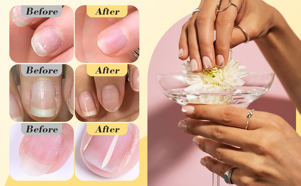 Nail Growth Oil
