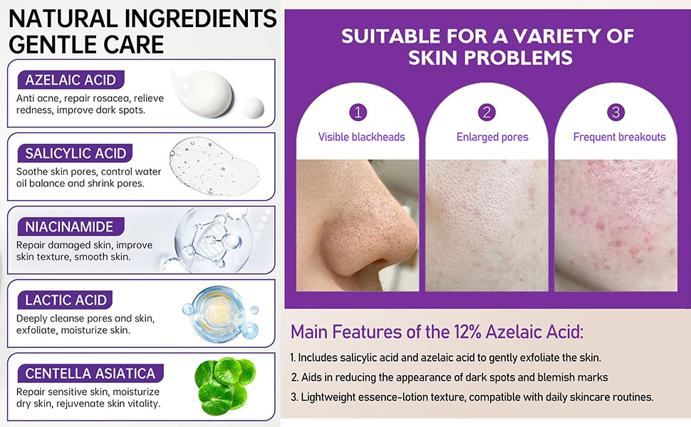 FUNI Azelaic Acid Serum, Booster 12% Azelaic Acid Cream, Hyaluronic Acid Serum & Niacinamide for Face, Facial Cream, Balance Excess Sebum,Smoothing Skin and Blemish,Pore Cleansing 1pcs 21 This cream helps tighten pores, removes impurities, and purifies your skin for a clearer complexion.