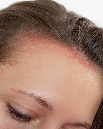 irritated skin support