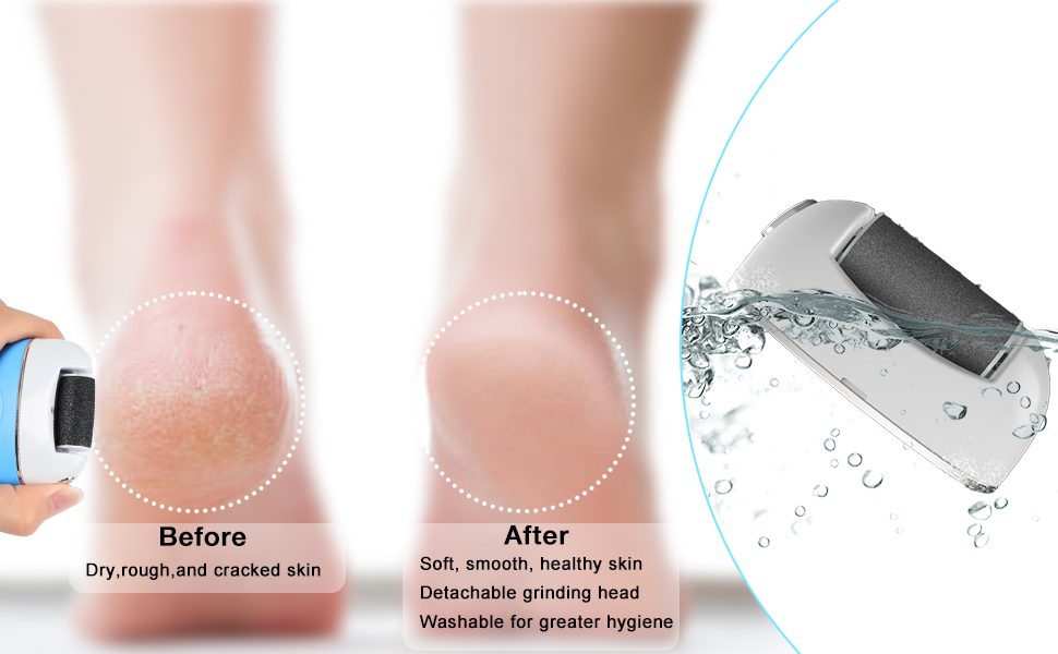 dermave electric foot callus remover foot file electric electric callus remover