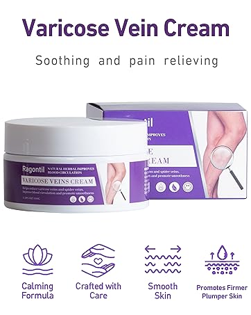 sprider Veins treament