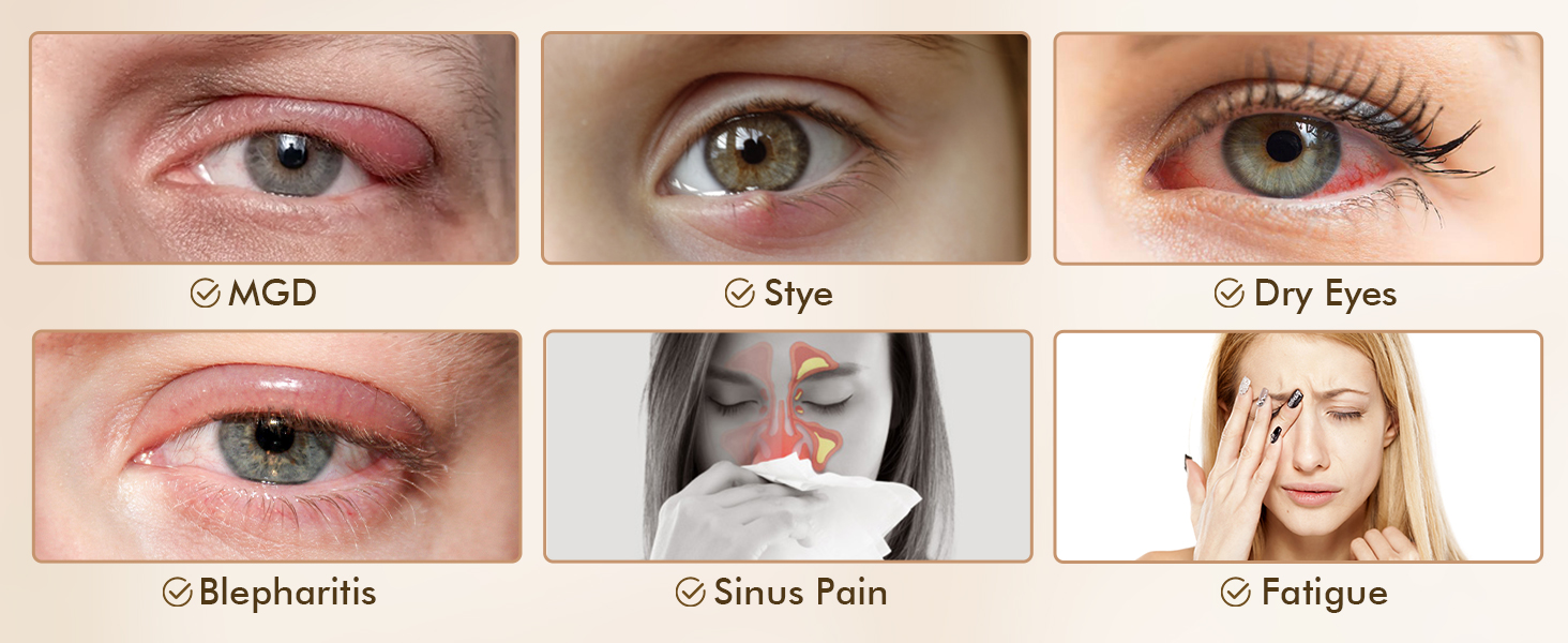 Heated Eye Mask, 100 Cotton USB Warm Eye Compress for Dry Eyes, Styes,MGD