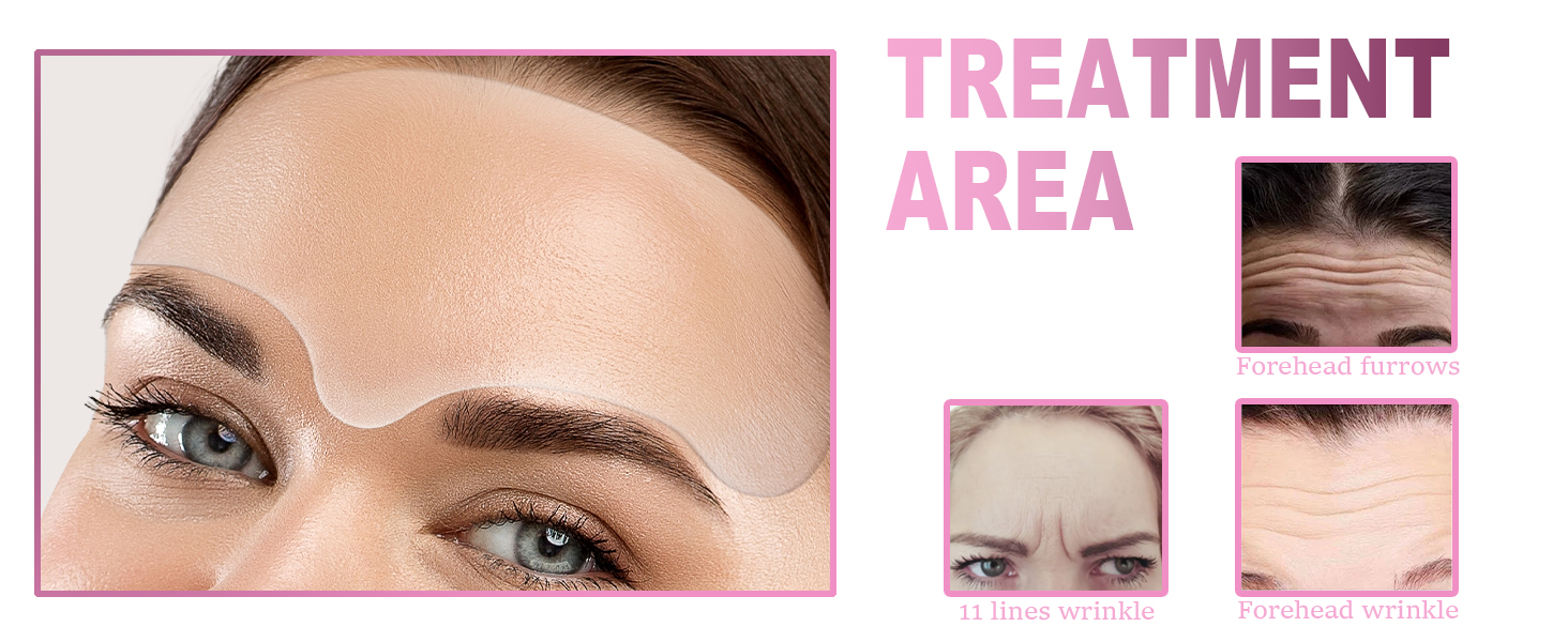 Akissos Forehead Wrinkle Patches Silicone Reusable Forehead Wrinkles Treatment