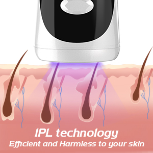 ipl laser hair removal