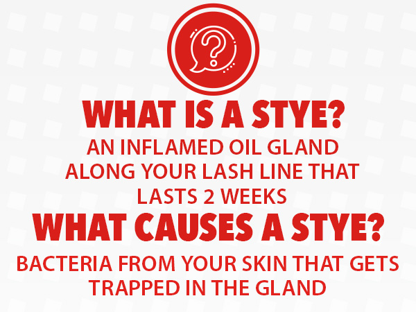 what is a stye