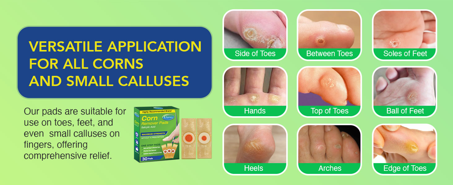 Versatile Application for All Corns and Small Calluses