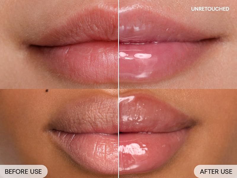 LGB Berry B&amp;A