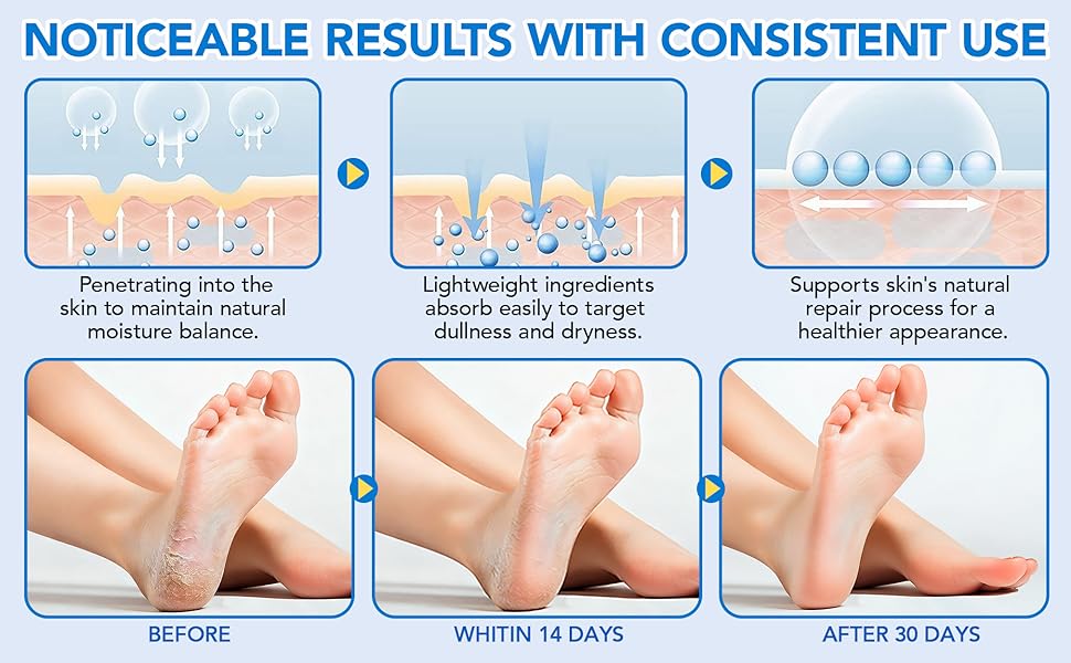 urea stick for feet 5