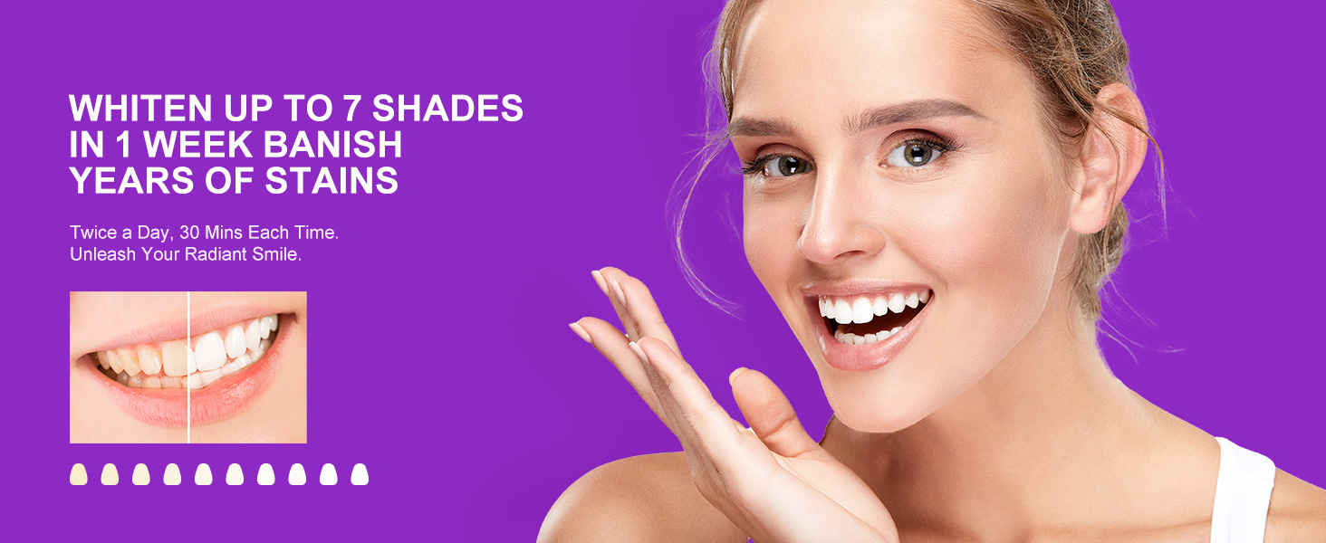 best whitening strips