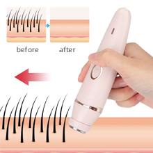 hair remover for women