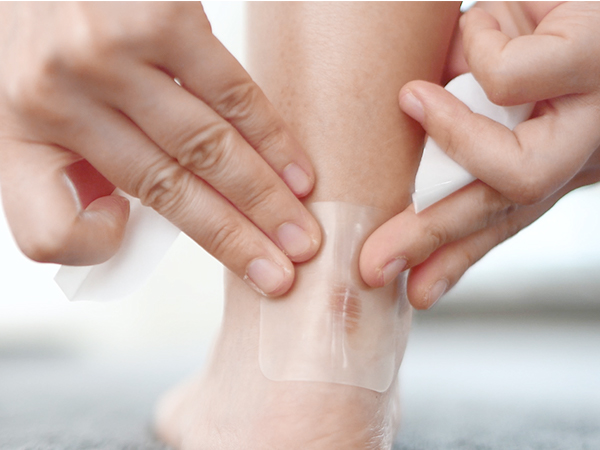 Hydrocolloid Wound Dressing