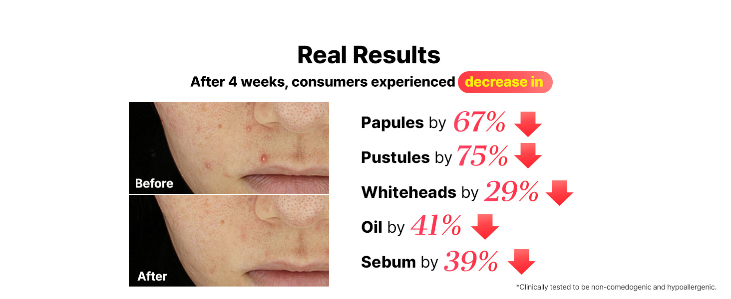 AHA 2 BHA 2 Blemish Serum