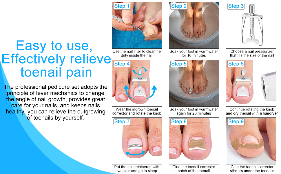 Ingrown Toenail Treatment Tools are easy use and work well when you follow the instructions