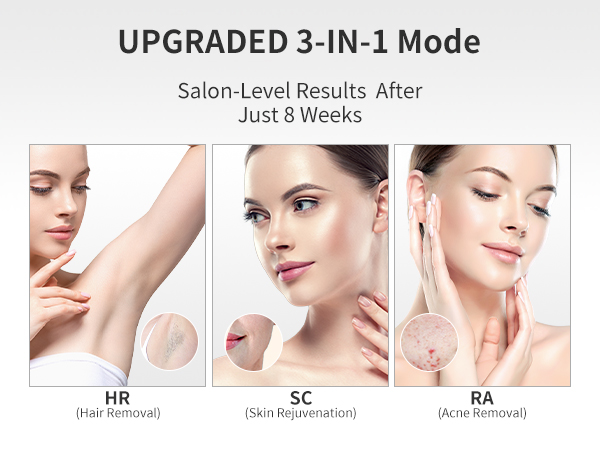 laser hair removal